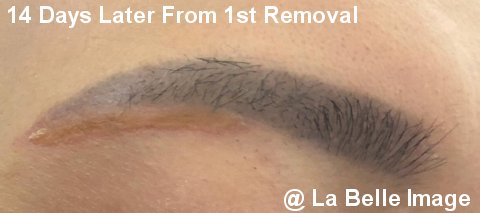 Permanent Make Up Eyebrows 14 Days Later From 1st Removal